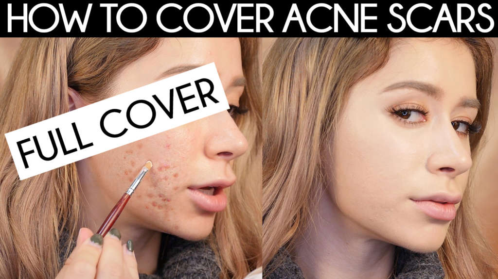 makeup to cover acne scars
